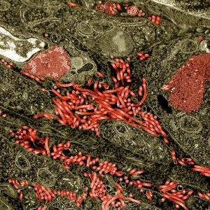 Colorized transmission electron micrograph of the ovary from a nonhuman primate infected with Ebola virus. Characteristic filamentous Ebola virus particles are present between cells (bright red). Intracytoplasmic Ebola virus inclusion bodies forming crystalline arrays can be seen within ovarian stromal cells (darker red). NIAID
