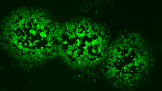 Poxvirus, which produces a green fluorescent protein, can replicate quickly in human cells unless resveratrol, a compound found naturally in many foods, is present, according to a study by researchers at Kansas State University and Centers for Disease Control and Prevention. Image/KSU