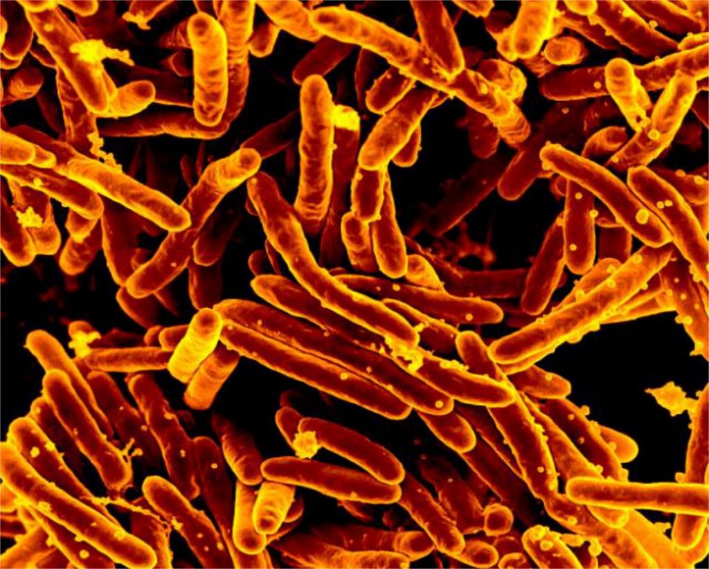 Scanning electron micrograph of Mycobacterium tuberculosis, the bacteria that cause tuberculosis. NIAID