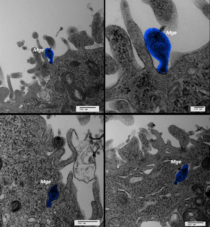 Transmission electron microscopy images in which the bacterium ycoplasma genitalium (Mgen) can be observed adhered to the surface of a human cell (top images) and penetrating the interior of the cells (bottom images). Images have been edited to facilitate the identification of the mycoplasma (in blue). Image/IBB-UAB/IBMB-CSIC